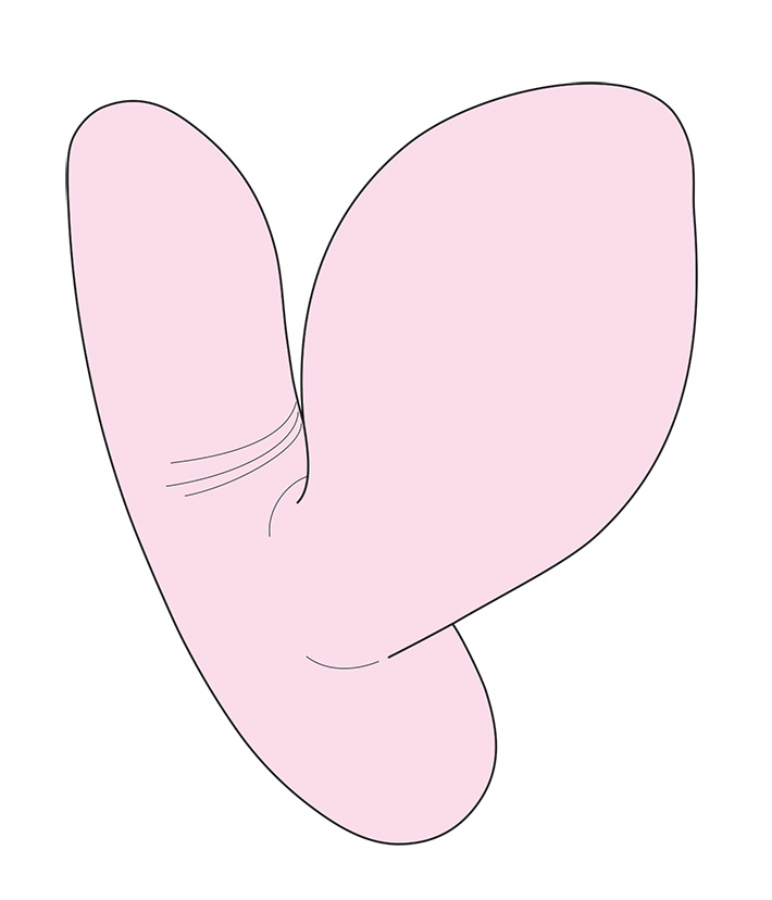 nemo：Squeezeのイメージ01